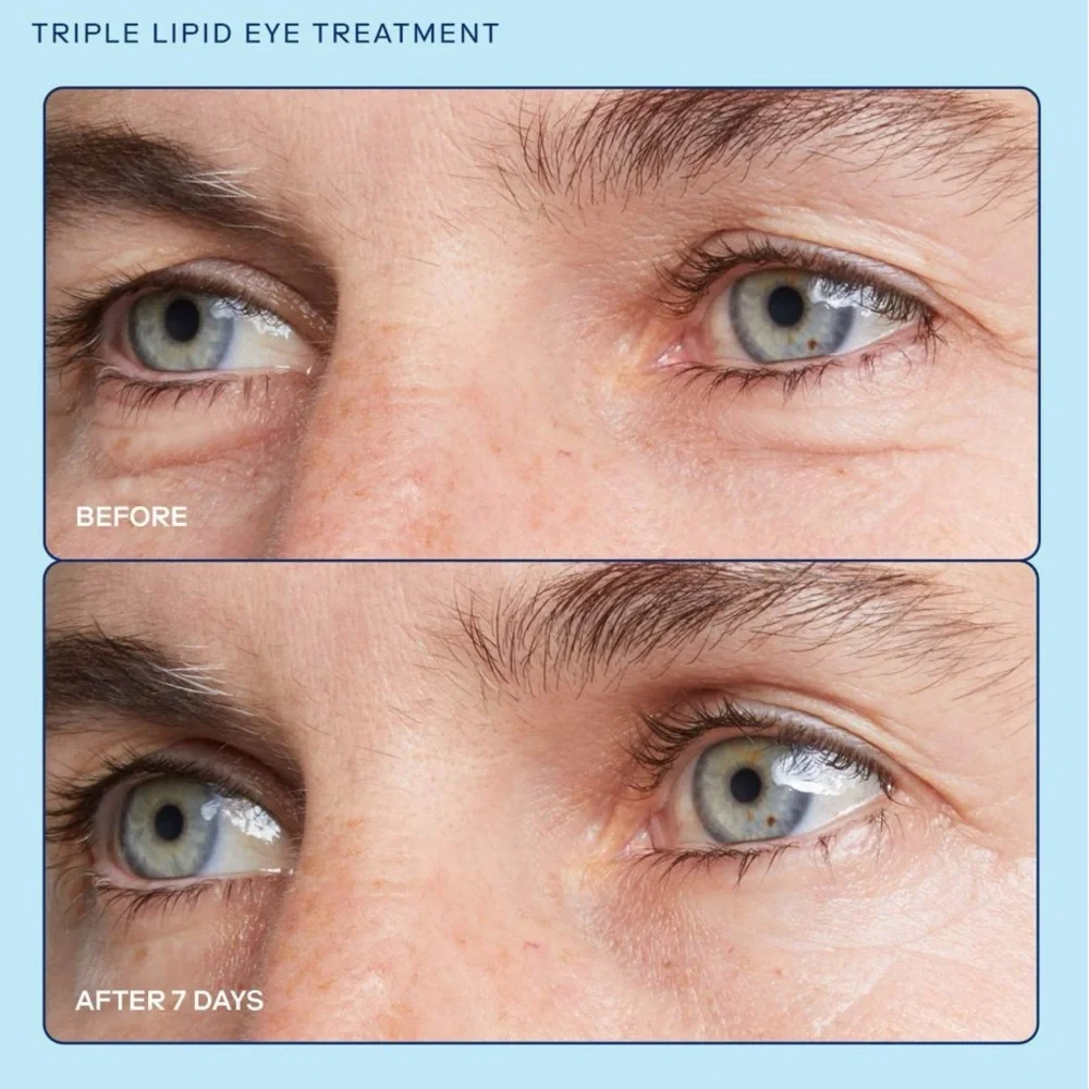 💦 skinfix barrier+ Triple Lipid + Collagen Eye Treatment
